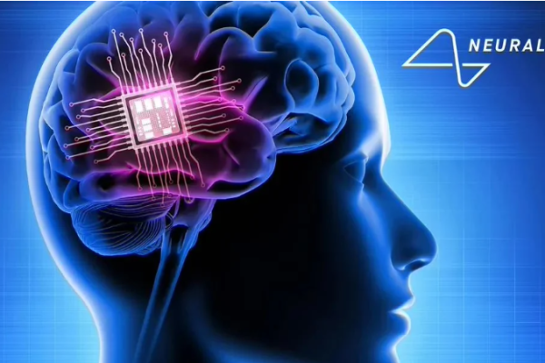 Neuralink Launches Implant Study, Seeking Three Patients for Groundbreaking Research